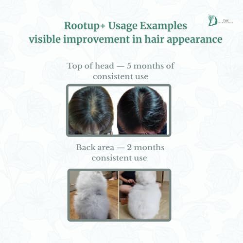 [THY rootup+] Botanical Hair Tonic ? Herbal Scalp Spray for Fuller-Looking Hair | Non-Greasy Formula with Korean Plant-Based Formula | For Men & Women |250 ml / 8.45 fl oz
