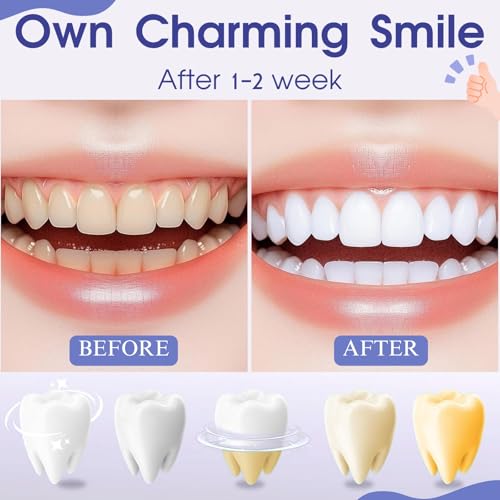 Teeth Whitening Pen, Teeth Whitener Kit Tooth Whitening Pen Gel Effective for Professionally Stain Removal, Painless, Low Sensitivity(Pack of 2)