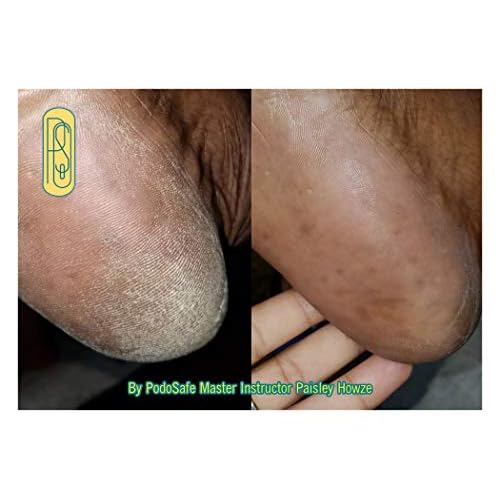12 oz PodoSafe