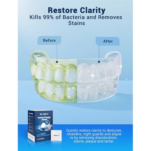 Retainer Cleaner Tablets (120 pcs), Denture Cleaning Tablets for Invisalign, Night Mouth Guard for Aligners, Remove Odors Stains and Plaque, Quick Cleanser, Mint Fresh Flavor, 4 Month Supply