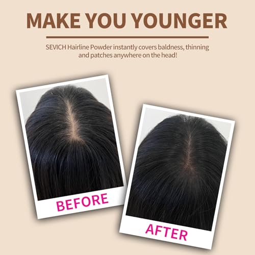 Sevich Hairline Powder,Instantly Conceals Hair Loss, Root Touch up Powder, Hair Shadow Toppers for Women & Men, Touch Up for Thinning Gray Hair, Windproof & Sweatproof,Medium brown