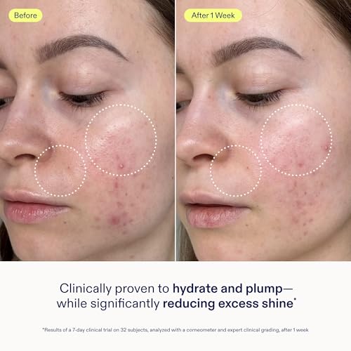 Skinfix Skin Barrier Restoring Gel Cream - 1.7 oz Refill - Non-Greasy Moisturizer for Normal to Combination Skin - Hydrates, Plumps & Smooths - Non-Comedogenic, Fragrance Free, Vegan, Cruelty Free