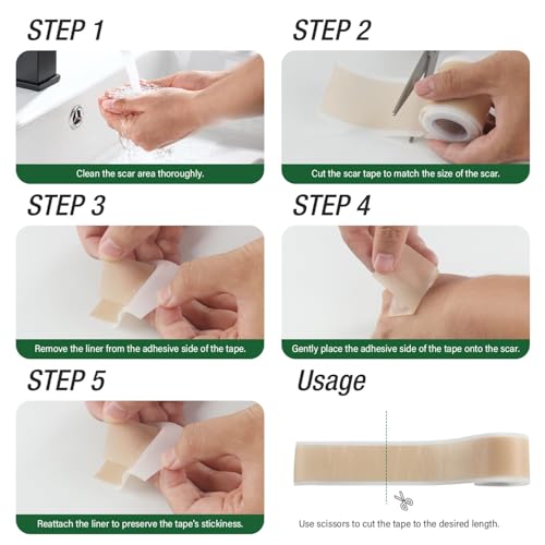 Silicone Scar Sheets,Silicone Scar Tape,Silicone Sheets For Scars,Scar Tape For Surgical Scars,Keloid Bump Removal,Scar Removal For Surgical(1.6"x 120" Roll-3M)