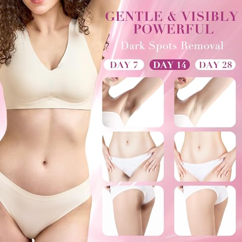 Skin Lightening Cream, Dark Spots Remover for Body Even Toning, Effectively Whitening Women Intimate Areas, Bikini Line, Underarms, Knees, Elbows, Renew Complexion and Replenish Skin Barrier