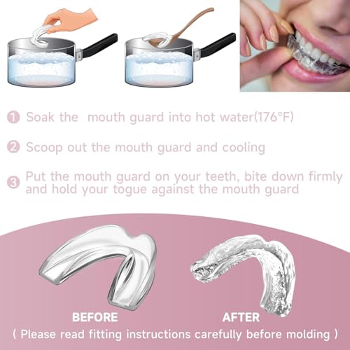 4 Pack Pink Kids Mouth Guard for Grinding Teeth, Moldable Kid Mouth Guard for Clenching Teeth at Night, Comfortable Mouthguard Stops Bruxism, TMJ