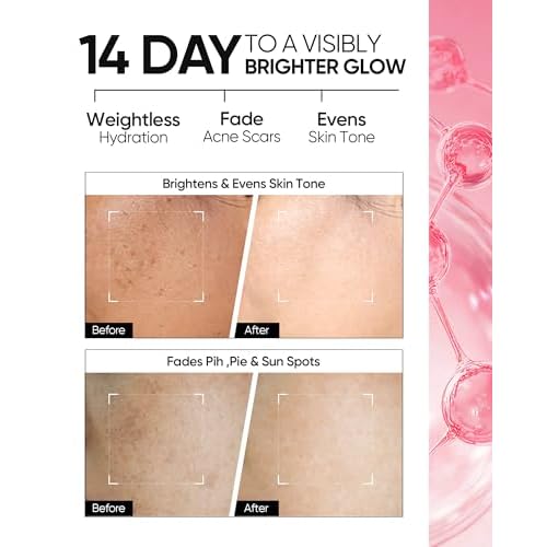 MSH Niacinamide Brightening Cream,Fades Dark Spots, Evens Skin Tone, Tranexamic Acid, ¥á-Arbutin, 5X Ceramides, Centella Asiatica, Suitable for Oil skin, 2.67 oz / 80g