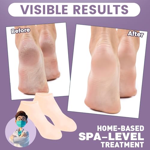 5 Pairs Silicone Socks for Dry Cracked Feet, Women's Foot Socks for Moisturizing (Beige, Fits Up to Size 9)