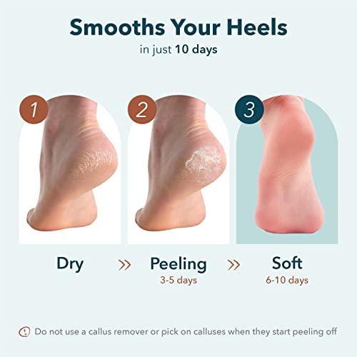 Purederm Exfoliating Heel Mask (1 Pair) ? Heel Peeling masks gently remove calluses from your heel