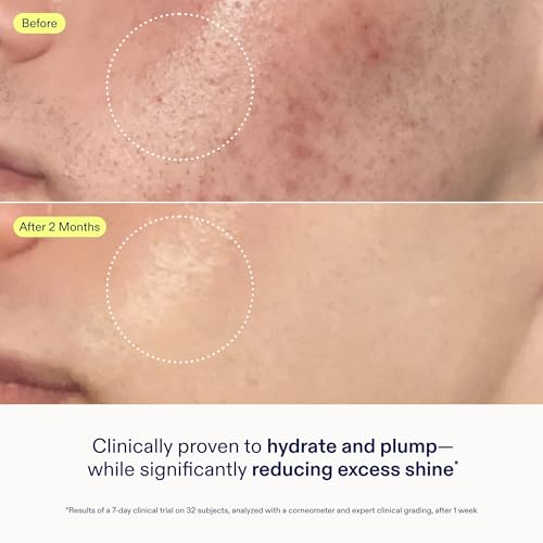 Skinfix Skin Barrier Restoring Gel Cream - 1.7 oz Refill - Non-Greasy Moisturizer for Normal to Combination Skin - Hydrates, Plumps & Smooths - Non-Comedogenic, Fragrance Free, Vegan, Cruelty Free