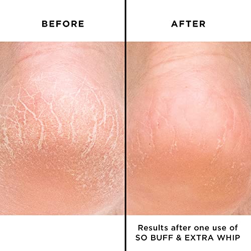 butter LONDON Extra Whip Hand & Foot Treatment, Shea & Cocoa Butter, Helps Hydrate & Restore Dry Skin, Helps Firm Skin¡¯s Appearance, Vegan, Cruelty & Paraben Free