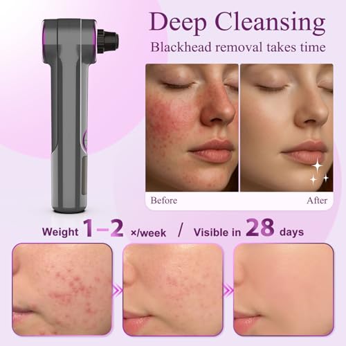 Blackhead Vacuum Removers, Pore Suction Cleaner with Heating, 3 Adjustable Suction Levels & 9 Modes, Comedone Extractor Kit with 5 Heads for Nose & Electric Face Deep Pore Cleansing