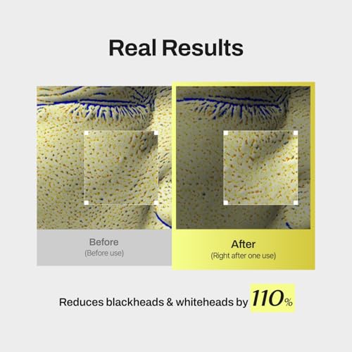 Niacin X BHA Pore Mild Clear Toner Pad - Korean Toner Pads for Face - Hydrating Face Toner for Pore Minimizer - Exfoliating Pore Care with Dual-Sided Pads - Gentle Blackhead Remover, 60 Pads