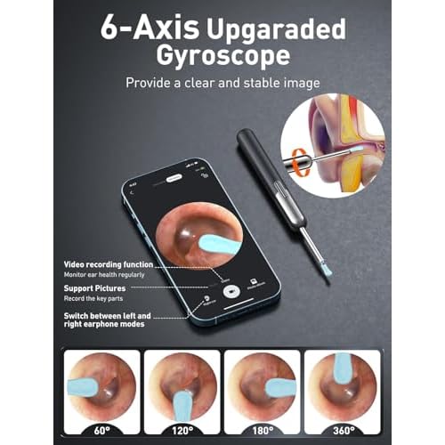 Ear Wax Removal, Ear Cleaner with Camera and Light, Ear Wax Removal Kit, Ear Wax Removal Tool Camera with 1080P, Ear Cleaning Kit with Spoons, Ear Camera for iOS & Android