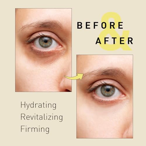 Under Eye Patches for Dark Circles: Snail Mucin Gel Masks for Puffiness Undereye Bags Wrinkles - Instant Brightening Moisturizing Skin Treatment Pads - Gift for Men and Women, 30 Pairs (White)