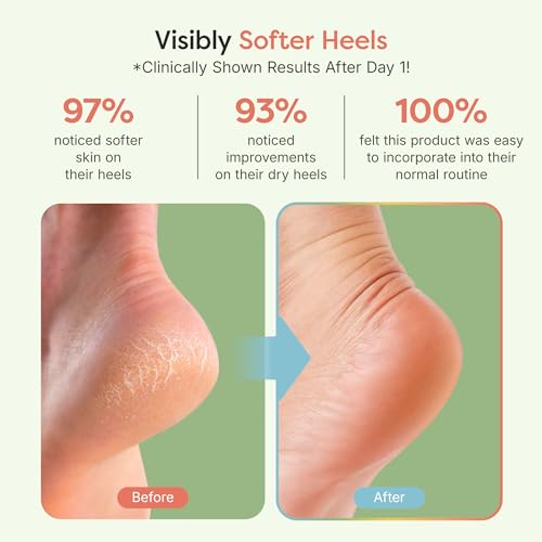ZenToes Moisturizing Socks for Cracked Heel Treatment, Vitamin E, Olive Oil and Jojoba Oil Heel Socks, Stocking Stuffers for Women, Spa Self Care Gifts for Women (Holiday Stripes, Regular)