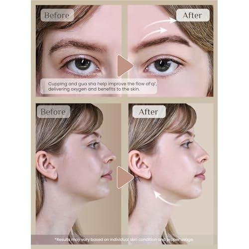 Rena Chris Facial Cupping Set & Gua Sha Facial Tool - Silicone Cupping Set & Rose Quartz Gua Sha Stone - Face Cupping Therapy Set for Natural Skin Care, Puffiness, Lip Plumping(Pink)