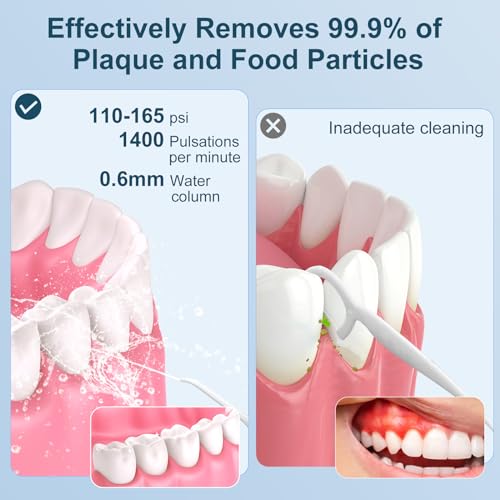 300mL Cordless Water Flosser with 5 Modes & 4 Tips | 30-Day Battery, IPX7 Waterproof | for Travel, Braces, and Deep Cleaning | Professional Smile, Anywhere