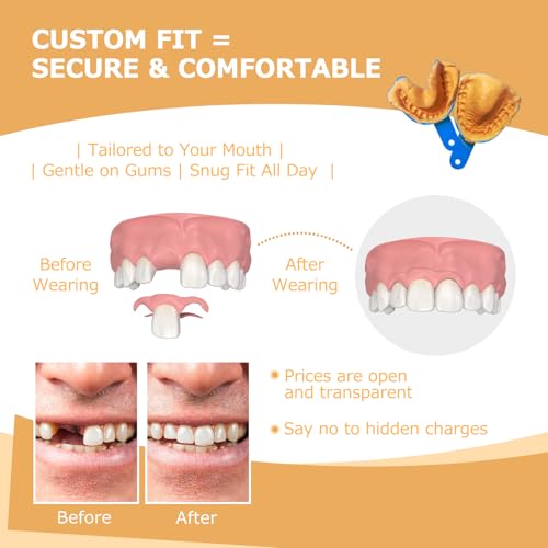 Partial Dentures - Dentures for Missing Teeth & Gaps - Lightweight & Unbreakable Replacement Teeth for Men & Women (2 Teeth)