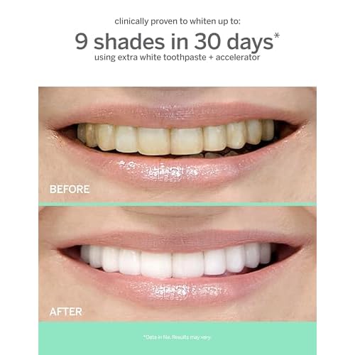 Supersmile Extra White Professional Whitening Accelerator - Enamel-Safe Teeth Whitening Gel - Effectively Lifts Deep-Set Stains without Sensitivity - 7 oz