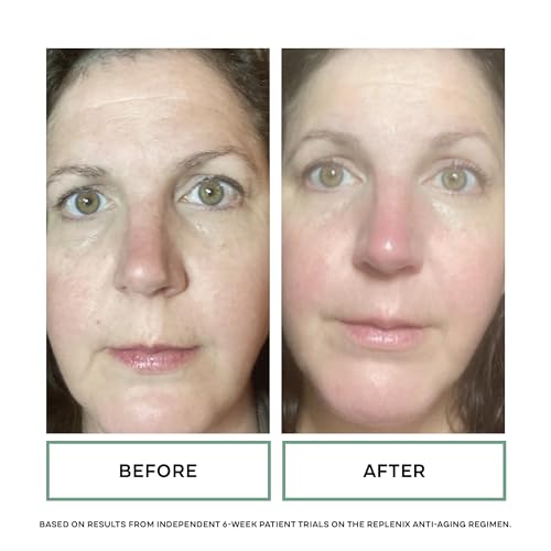 Replenix Growth Factor Restorative Facial Serum, Anti-Aging Treatment with Medical-Grade Ingredients for Mature Skin (1 fl. oz)