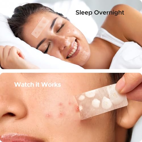 TKTK Large Pimple Patches for Face, 7 Sizes XL Acne Patches, Big Hydrocolloid Bandages for Body, Chin, Forehead, Chest, Back Zit Breakouts, Hydrocolloid Patch (Strip, Square, Dot 126 Count)