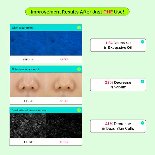 Calming Tok Cica Heartleaf Trouble Pads, Cooling & Hydrating Facial Toner Pads for Sensitive Skin, Mild Exfoliating & Soothing, Easy-Split for Multi-Use, Daily Korean Skin Care (70 Sheets)
