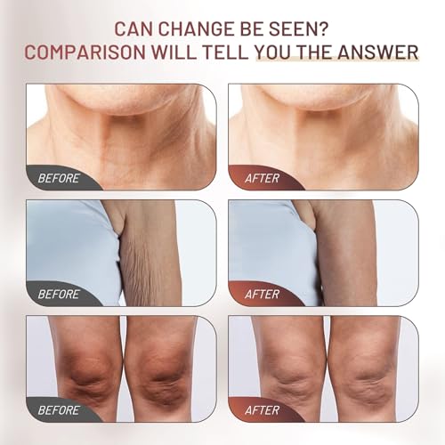 Moisturizing Crepe Fix Cream ? Tightens and Firms Face, Neck & Body, Anti Wrinkles for Crepey and Sagging Skin, Women & Men, 4.23 Fl Oz
