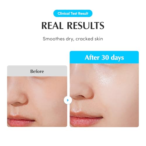 EQQUALBERRY Swimming Pool Ampoule - Hyaluronic Acid Serum for Glass Skin | Deep Hydration and Soothing with CICA Extracts | Korean Skin Care Serum, 1.69 Fl. Oz. 50ml