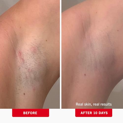 First Aid Beauty - Ingrown Hair Pads with BHA + AHA - Aftershave Treatment Pads to Help Prevent Razor Bumps for Men & Women - Exfoliate Underarms & Bikini Area - Compostable for Daily Use - 28 Pads