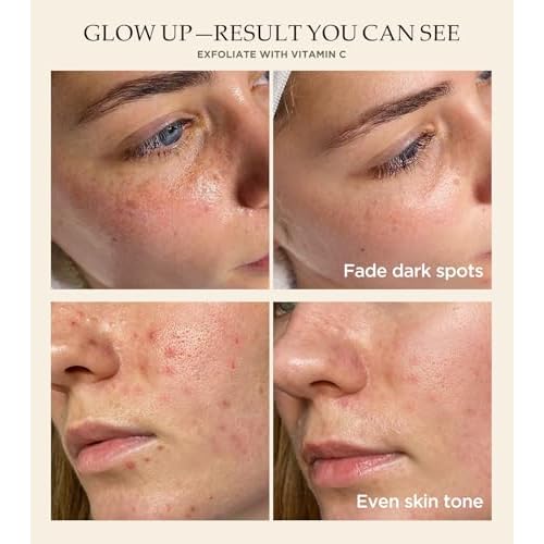 Vitamin C and Turmeric Face Scrub, Face Scrub for All Skin Types -Physical Scrub to Exfoliate Face & Body, Anti Aging Facial Exfoliating Scrub, Clears Blackheads Improve Dark Spots 4.23 Oz