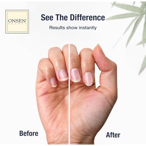 Onsen Nail & Cuticle Cream Treatment w/Japanese Tsubaki, Jojoba & Lavender Oil, Shea Butter - Strengthens Nails, Softens Cuticles - Daily Repair Care (1 Count/15 ml)
