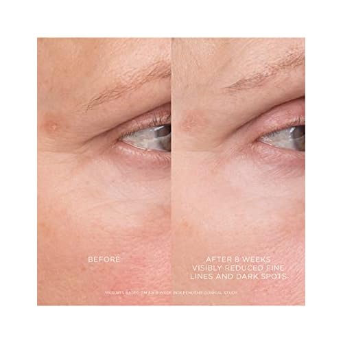 Hourglass Equilibrium Resurfacing Retinoid Treatment
