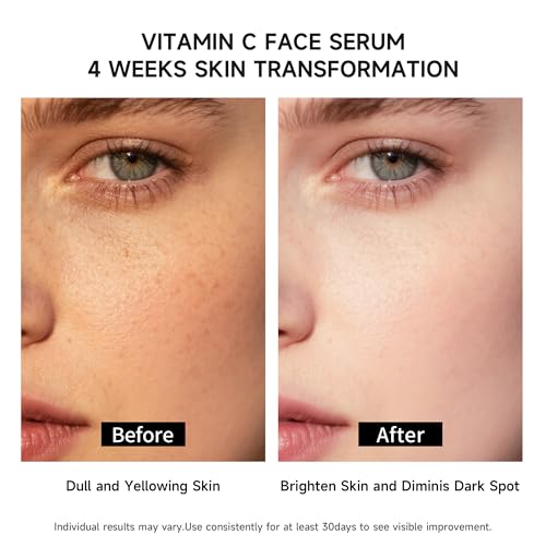 Vitamin C Face Serum with Glutathione, 4D Hyaluronic Acid & Aloe Vera ? Lightweight Brightening & Hydrating Ampoule for Daily Skincare, Dark Spots, Sensitive Skin Friendly - (1.0 ml)*30 Vials