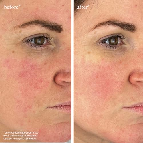 goop Beauty Peptide Serum | Reduces Fine Lines, Wrinkles, & Dark Spots | Peptides, Ceramides, & Niacinamide | Anti Aging Treatment to Improve Firmness & Elasticity | 1 fl oz
