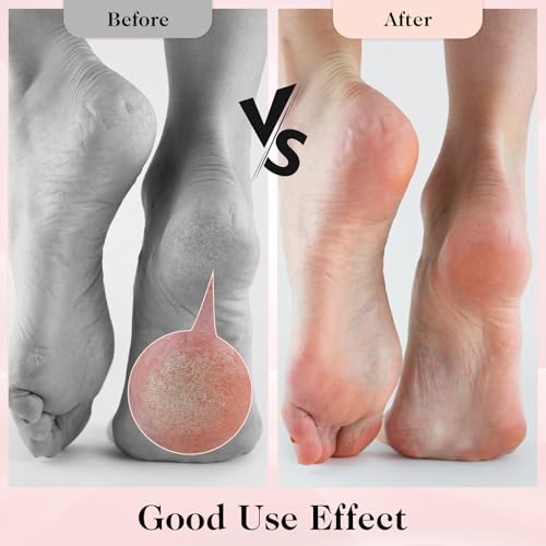 3 Pairs Aloe Infused Socks Lotion Socks Moisturizing Spa Socks Non Slip Coral Fleece Socks for Repairing Softening Dry Cracked Feet Infused Gel Sleeping