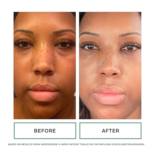 Replenix Vitamin C Pro Collagen Serum, Brightening Anti-Aging Face Treatment with Medical-Grade Antioxidants for Skin Discoloration