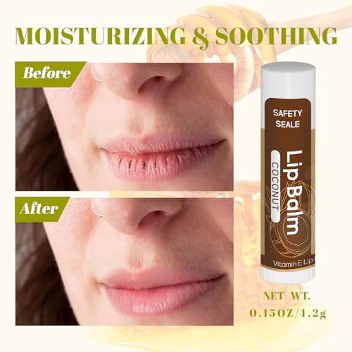 Yopela 36 Pack Natural Lip Balm Bulk with Vitamin E and Coconut Oil - Moisturizing, Soothing, and Repairing Dry and Chapped Lips Valentine's Gift- 12 Flavors - Non-GMO