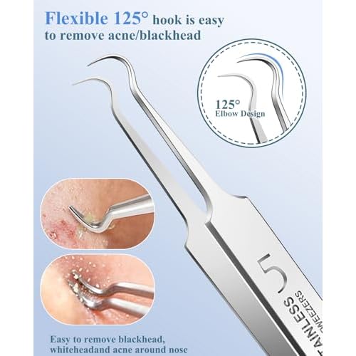 5PCS Blackhead Remover Pimple Popper Tool Kit, Professional Stainless Pimple Acne Blemish Removal Tools Kit for Face (Silver)