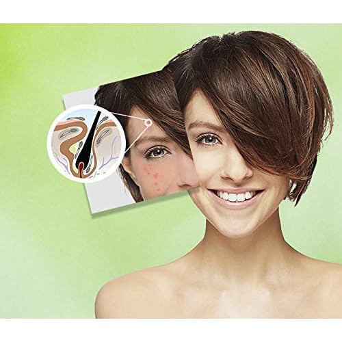 Ungex Demodex Defence Cleanser | Face, Scalp and Body Wash | Herbal Based | DDC