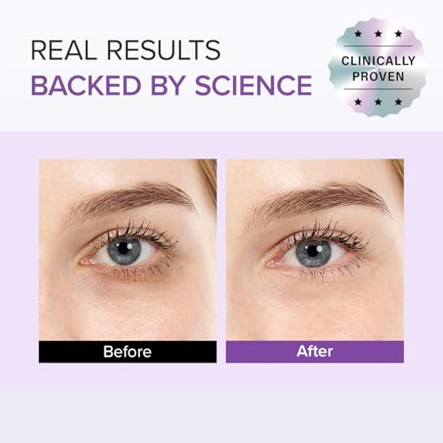 Mary&May Tranexamic Acid (TXA)+Glutathione Eye Cream | Dark Circles & Hyperpigmentation | With Niacinamide & Vitamin C | Firms Under Eye Area | Wrinkle & Fine Line Care | Korean Skincare, 1.01 oz.