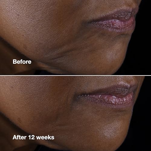 Clinique Smart Clinical Repair Anti Aging Lifting Face + Neck Cream with Peptides + Hyaluronic Acid For All Skin Types | Hydrating