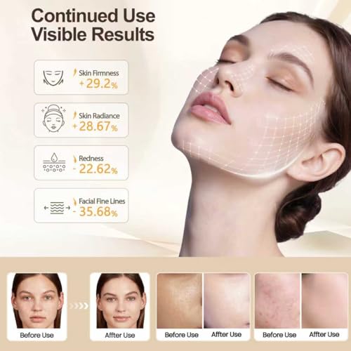 Red Light Therapy for Face 7-Color Light Modes£¬3-in-1 Fusion LED Beads£¬1200 mah Red Light Therapy Mask with Timer for Home & Travel£¬yoga & Relaxation - Ideal Choice for Skincare Lovers