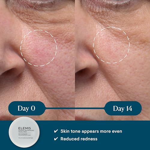 ELEMIS Dynamic Resurfacing Facial Pads, Gentle Textured Treatment Facial Exfoliating Pads