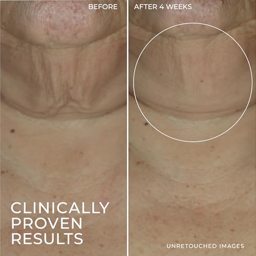 RoC Derm Correxion Retinol Firming Serum Stick with Antioxidants to Visibly Tighten and Firm Wrinkles and Laugh Lines 1.0 oz plus Retinol Eye Cream Packette