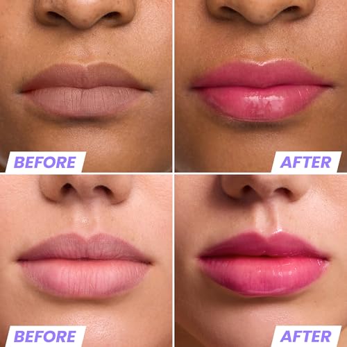 Wonderskin Lip Oil Rehab Serum - Color Changing Lip Oil from Clear to Pink - PH-activated, Non-sticky & Hydrating Tinted Serum for Dry Lips (Kissed)