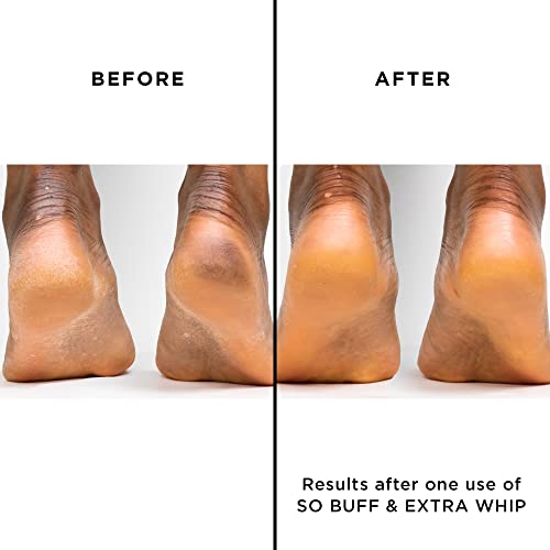 butter LONDON Extra Whip Hand & Foot Treatment, Shea & Cocoa Butter, Helps Hydrate & Restore Dry Skin, Helps Firm Skin¡¯s Appearance, Vegan, Cruelty & Paraben Free