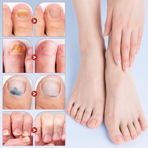 Nail Patches, 8-Hour Overnight Treatment, Fast-Acting Toenail Repair Patches, 21 Patch,for Damaged Nails Foot Nails Repair and Care,Strengthens Brittle Nail