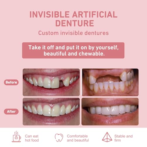 Custom Partial Dentures ? Personalized Removable Denture Set for Missing Teeth | 1?6 Tooth Replacement with Storage Case | Natural Look & Comfortable Fit (2 Teeth)