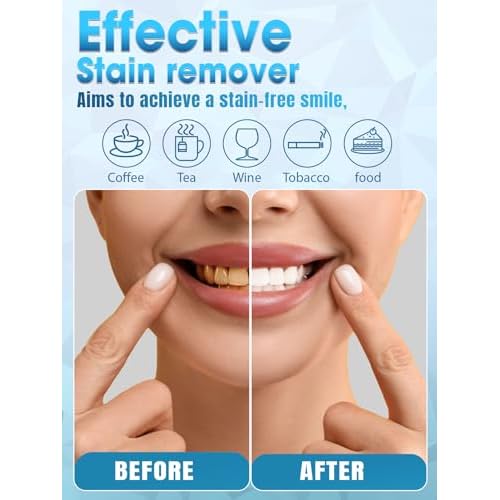 Teeth Whitening Kit with LED Light - White Sensitive Tooth 35% Carbamide Peroxide Gel Pen Dental Mouth Trays Whitener Professional Bright Brace Product System for Home Work Travel