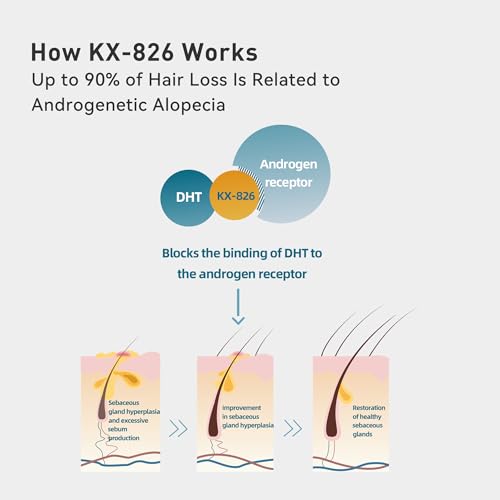 KINTOR 0.9% KX-826 Hair Regrowth Spray,Supporting Healthy Hair Growth,Oil Control, Hair Growth Products Group for Men&Women,Pro,60ml
